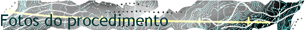 Fotos do procedimento
