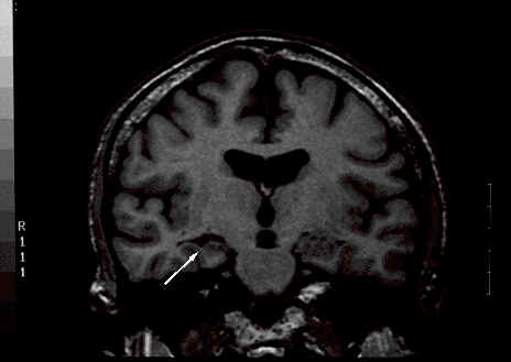 wpe6.jpg (12486 bytes)