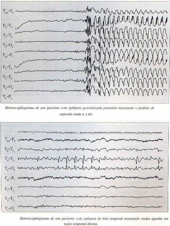 wpe31.jpg (73702 bytes)